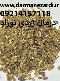 درمان زردی نوزاد با داروی گیاهی