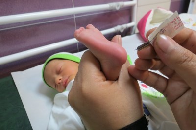 درجه زردی نوزاد