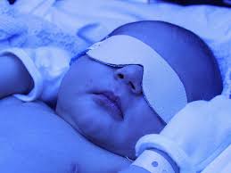 دلیل گریه نوزاد زیر دستگاه زردی 