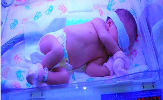 اجاره دستگاه زردی نوزاد در شهر قدس