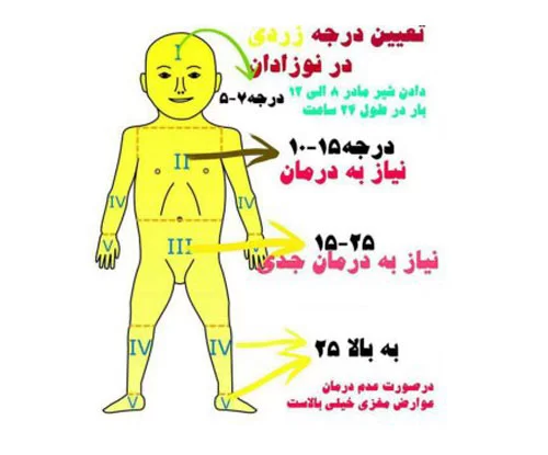 درجه زردی نوزادان